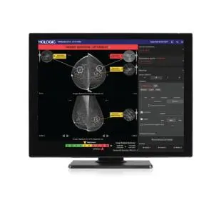 Hologic Genius AI Detection – syväoppiva rintasyövän tunnistus
